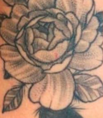REMOÇÃO_TATUAGEM_ANTES